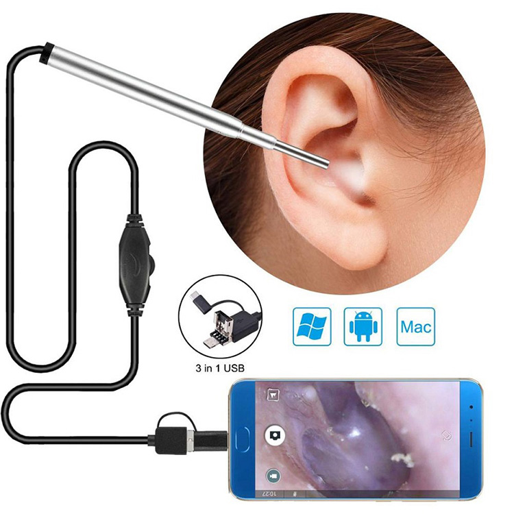 Cluas Ceamara Endoscope Leighis Endoscope Nasal Endoscope Usb